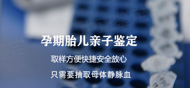 济南怀孕需要怎么做亲子鉴定,济南孕期亲子鉴定办理流程 济南怀孕需要怎么做亲子鉴定,济南孕期亲子鉴定办理流程