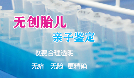 在[济南]怀孕期间如何办理亲子鉴定,济南产前亲子鉴定收费标准